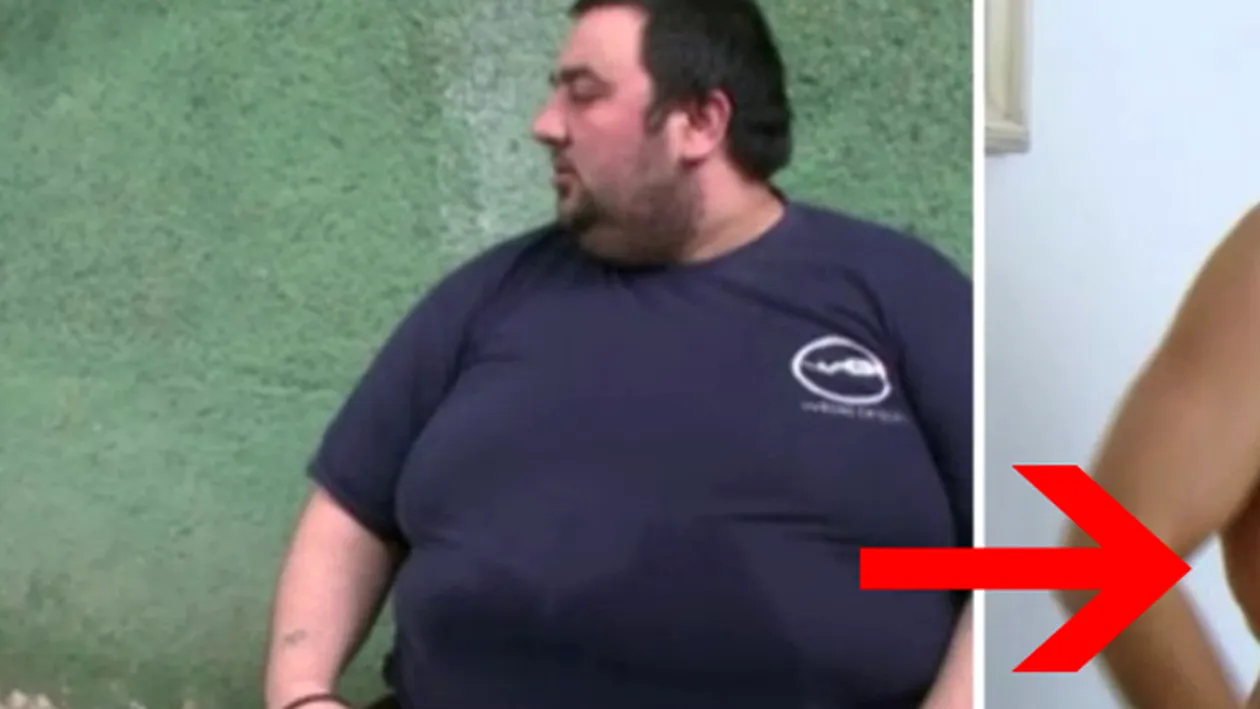 Un tanar din Romania suferea de obezitate morbida si avea 245 de kilograme! Cum arata dupa ce a slabit 150 de kilograme