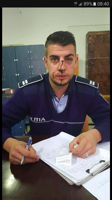 Agentul s-a ales cu nasul spart după ce a primit un cap în plină figură