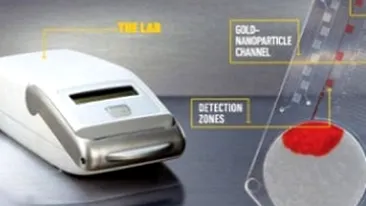 Virusul HIV si sifilisul pot fi depistate in cateva minute!