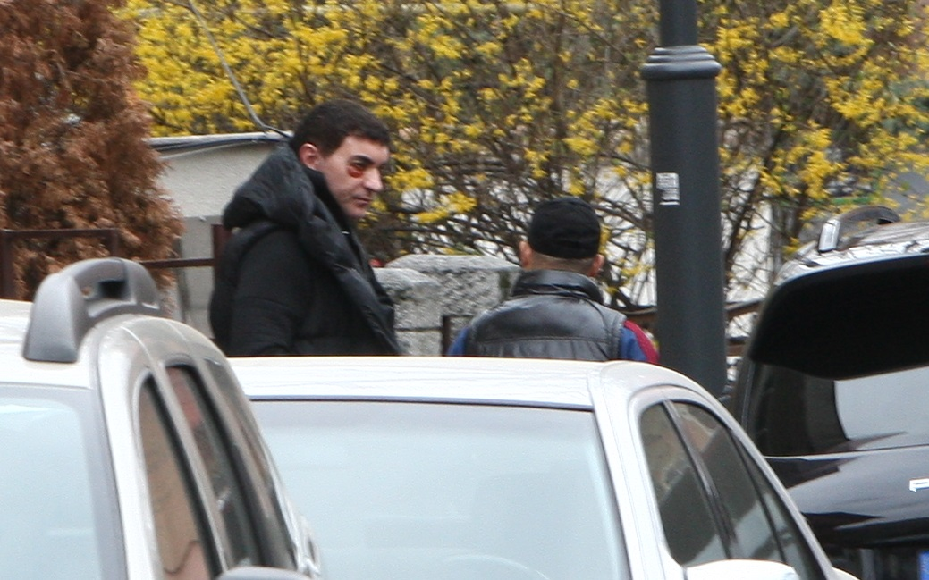 Cristi Borcea a avut nevoie urgentă de o mască anticearcăne