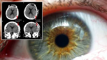 Descoperire ireală a oamenilor de știință. Ce se întâmplă după ce mori, de fapt. Mitul a devenit realitate