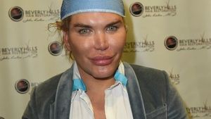 Păpuşa umană Ken şochează din nou! A cheltuit o sumă exorbitantă pentru transplant de păr şi s-a decis să....