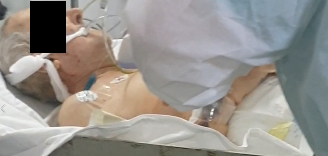 Pacientul cu coronavirus a fost internat într-o secție ATI non-COVID