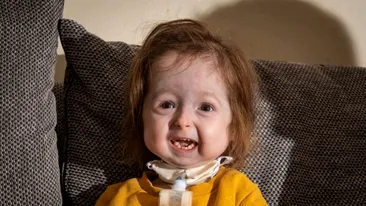 Fetiță de doi ani, singurul pacient din lume cu boala prezentată în filmul Benjamin Button