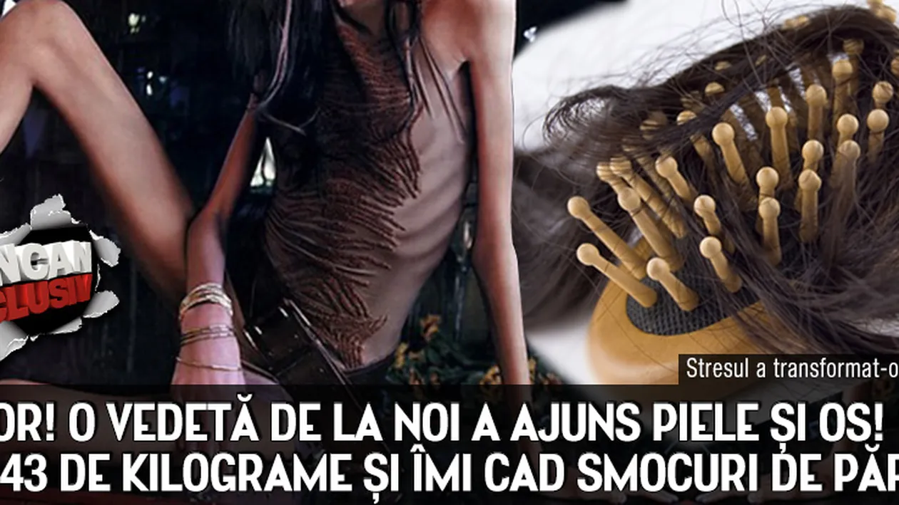 HORROR! O vedeta de la noi a ajuns piele si os! Am doar 43 de kilograme si imi cad smocuri de par!
