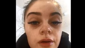 O studentă, la un pas să orbească după ce și-a făcut genele! I le-au pus cu lipici de unghii