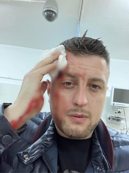 Nelu Popa, saxofonistul lui Carmen de la Sălciua, a fost lovit cu paharul în cap, într-un local, și a ajuns la spital (Foto: CANCAN.RO)