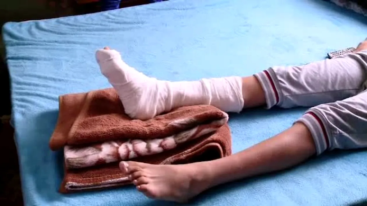 Un elev de 12 ani din Dolj și-a fracturat piciorul la ora de sport. Nimeni nu și-a dat seama!