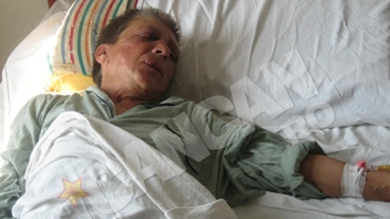 Intamplari de groaza la spitalul de boli mintale din Ganesti-Galati!  Snopita in bataie de colega de salon