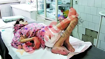 Cantareste 13 kilograme la 15 ani!