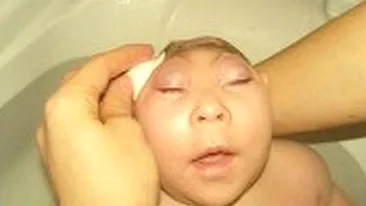 CUTREMURĂTOR! Cum s-a născut această copilă, pentru ca mama ei a consumat droguri in timpul sarcinii! Imagini greu de privit