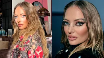 Delia a fost atacată de câini, ziua în amiaza mare: “M-am făcut praf”