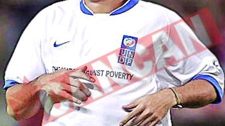 Ronaldo nu mai vede cu ochiul stang