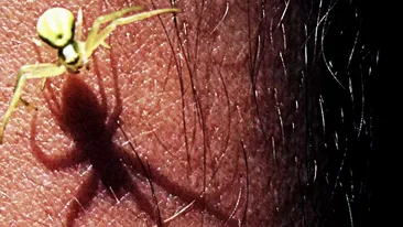 A mers la spital si doctorii i-au scos ASTA din ureche! Toti s-au ingrozit cand au aflat ca statea acolo de 5 ZILE!