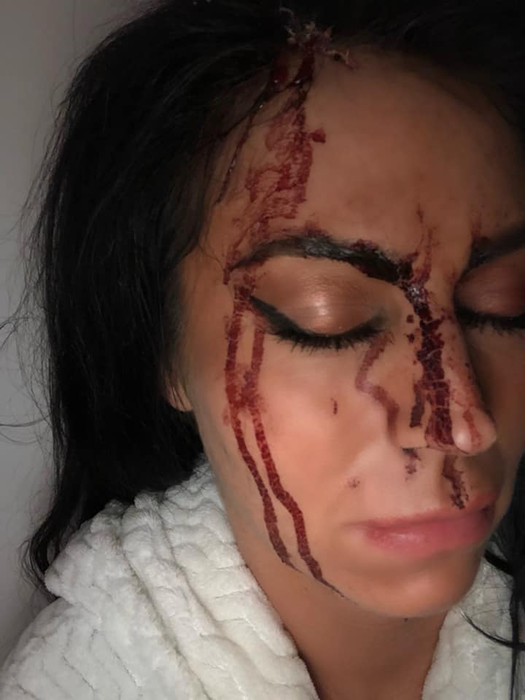 Prezentatoarea TV a ajuns plină de sânge la spital. Imagini cu puternic impact emoțional