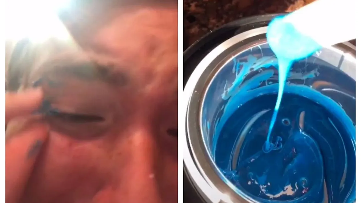 Îngrozitor! Ce a pățit o tânără, după ce a încercat să se penseze cu ceară. A trecut prin dureri cumplite!