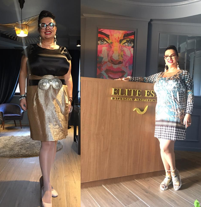 OZANA BARABANCEA, din ce în ce mai suplă! Vedeta a apărut în fustă scurtă
