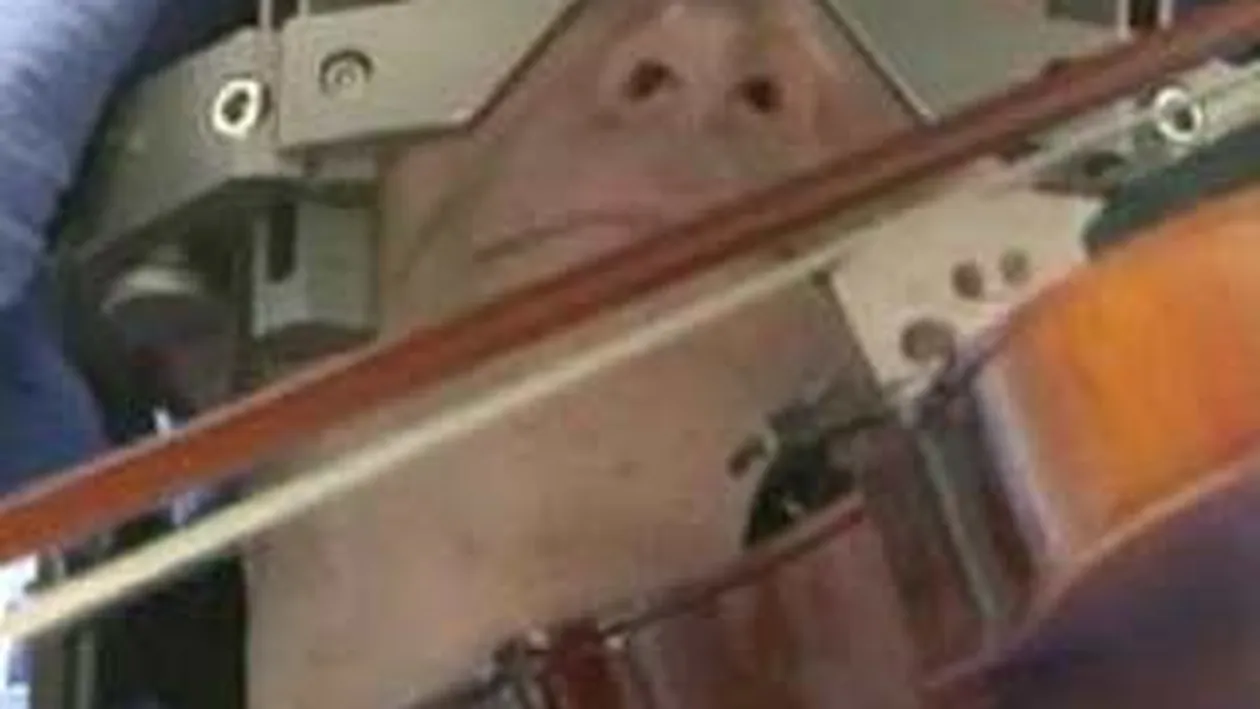 VIDEO INCREDIBIL! Un barbat canta la vioara in timpul operatiei pe creier!