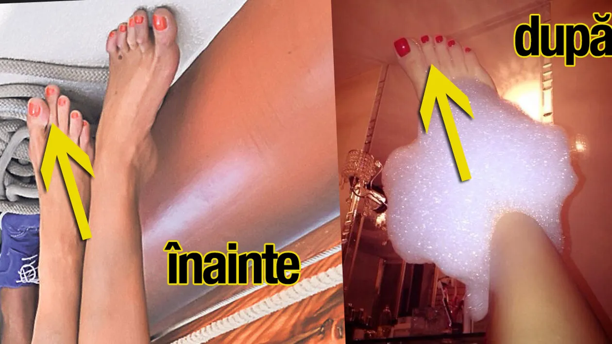 Gasesti diferentele intre poze? Adevaratul motiv pentru care Bianca s-a operat la Budapesta este fabulos: si-a taiat un deget