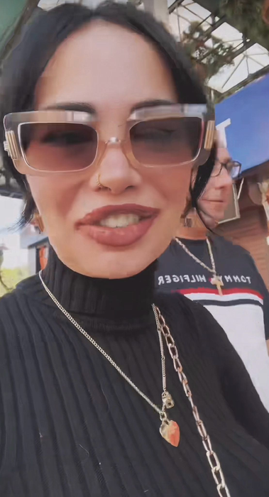 Alina Eriko începe să își revină. Cum arată acum, după ce și-a refăcut dantura