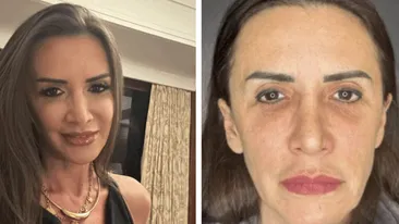 Mara Bănică, mesaj dur pentru cei care au criticat-o că și-a făcut lifting facial: ”Era mai bine să fi spus că m-am apucat de yoga?!”