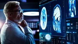 COVID-19 poate afecta creierul pe termen lung, chiar și în forme ușoare. Diferența majoră față de gripă