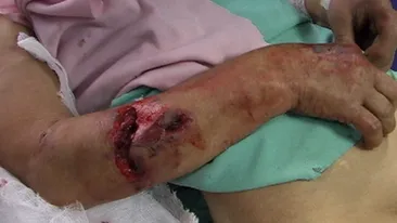 IMAGINI SOCANTE! Mutilata de 10 caini maidanezi!