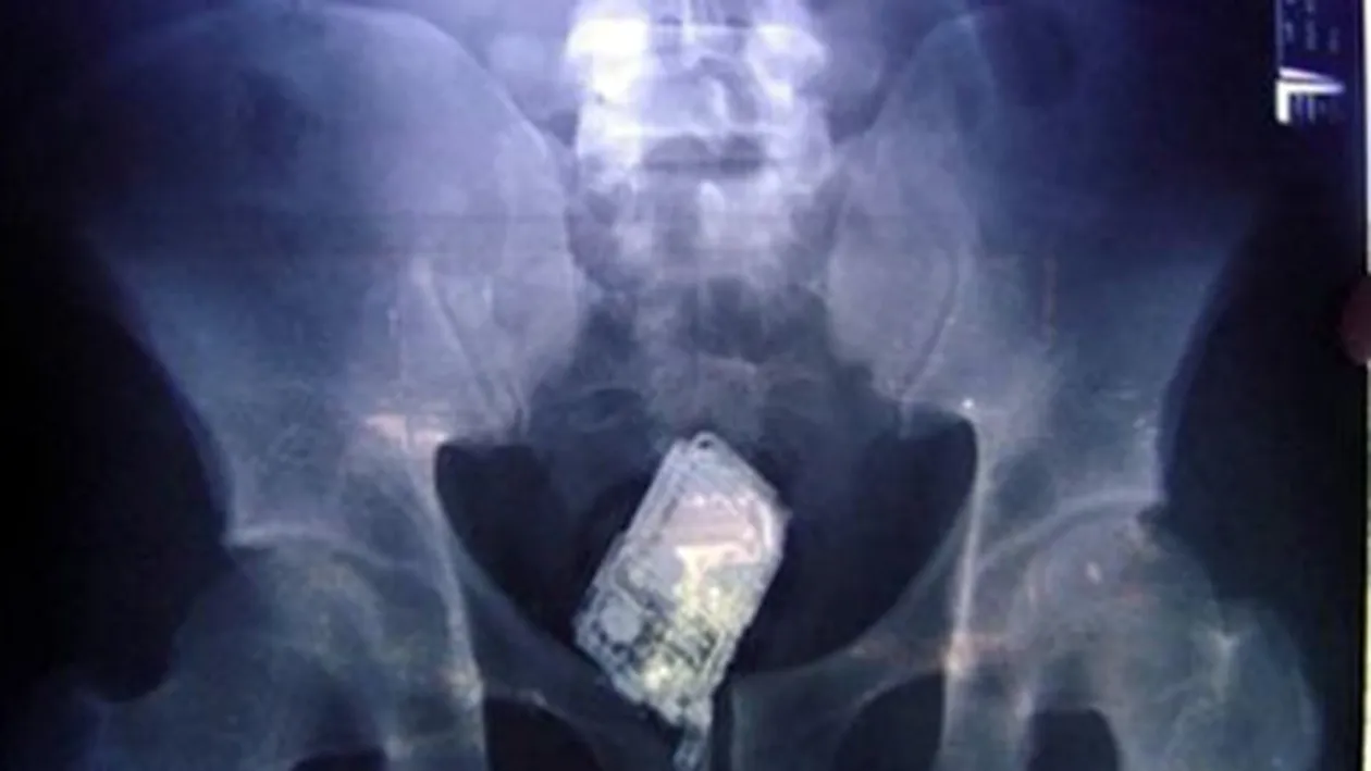 Un detinut si-a ascuns telefonul mobil in anus la Penitenciarul de la Poarta Alba! A refuzat sa fie operat si asteapta sa il elimine pe cale naturala