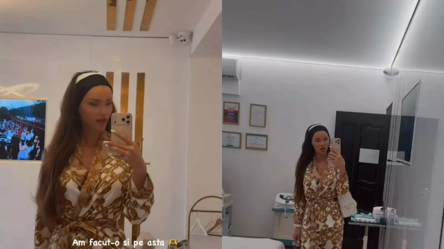 Bianca Drăgușanu și-a micșorat urechiile! Nu renunță la operații nici în ruptul capului: „Am făcut-o și pe asta”