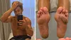 Cum arată tălpile concurenților de la Survivor, după ce au stat desculți 4 luni în jungla dominicană. Întors în România, Alberto Hangan a făcut publice imaginile