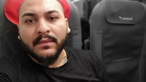 Cum arată acum Dani Mocanu, la nici o lună după ce şi-a făcut implant de păr. În primele zile era desfigurat