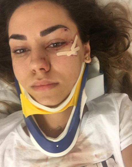 A rămas cu traume după accident, dar are curaj. Mira, prima călătorie cu maşina după accidentul grav în care a fost implicată. “Merg spre casă, dar…”