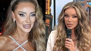 Bianca Drăgușanu, pregătită pentru o nouă intervenție la nas. Ce probleme a avut până acum