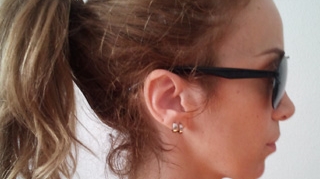 Annes a fost arsa pe gat cu ondulatorul de catre hair stylista! Cantareata se trateaza acum cu sange de vitel!