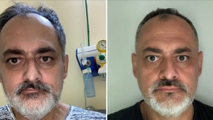 Cu ce sechele a rămas un român, la un an de când s-a vindecat de COVID-19: ”Nu este o glumă!”