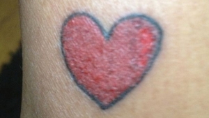 IMAGINI SOCANTE! Si-a facut un banal tatuaj, in forma de INIMA. Ce s-a intampla dupa cateva saptamani este INGROZITOR!