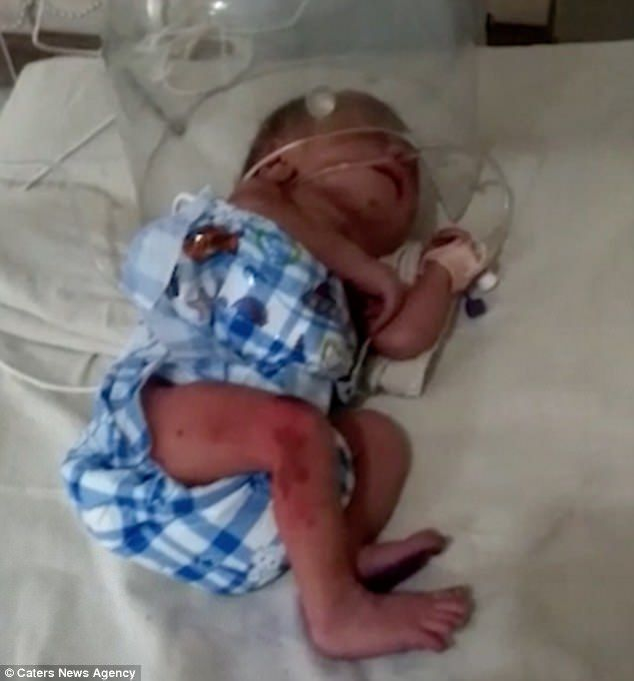 O fetiţă nou-născută a fost abandonată la gunoi de părinţi! Motivul halucinant pentru care au lăsat-o să o mănânce furnicile