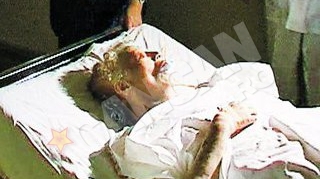 Alt caz de neglijenta la Spitalul Judetean Targu Jiu! In coma dupa o doza dubla de sange