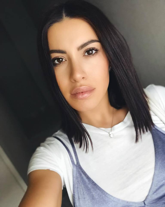 Nicoleta Nucă vrea să scape de un semn de la naștere: ”Am început o procedură cu laser”