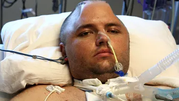 S-a lovit atat de tare incat era sa-i explodeze creierul! Medicii l-au salvat dupa ce i-au bagat capul la frigider