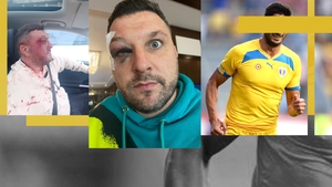 ”Mi-a spart arcada, mi-a spart tot!” Celebrul atacant care l-a refuzat pe Gigi Becali și-a umplut de sânge asociatul
