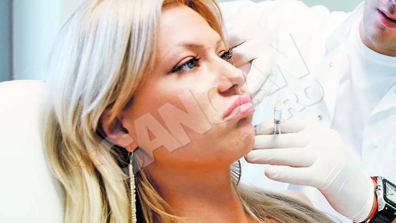 Simona Sensual sta pe bara dupa ce si-a injectat acid hialuronic! Nu-si foloseste buzele doua zile