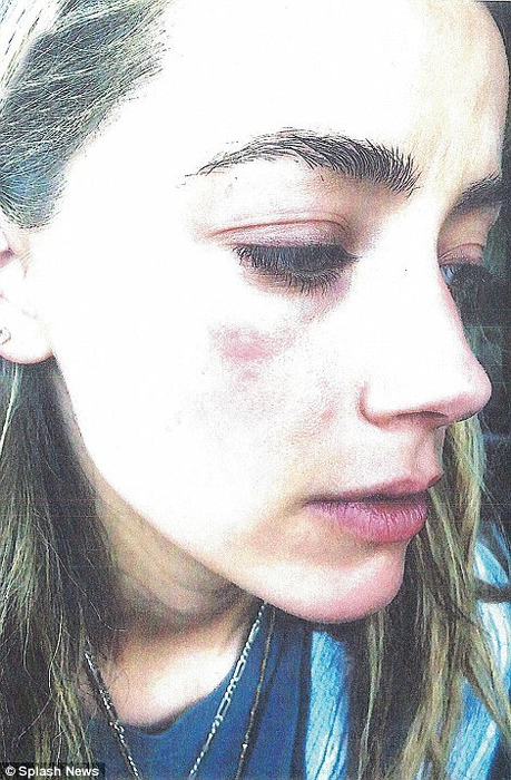 Un nou scandal zguduie Hollywood-ul! După ce a anunţat că divorţează de JOHNNY DEPP după doar 15 luni de căsnicie, AMBER HEARD l-a acuzat de violenţă domestică