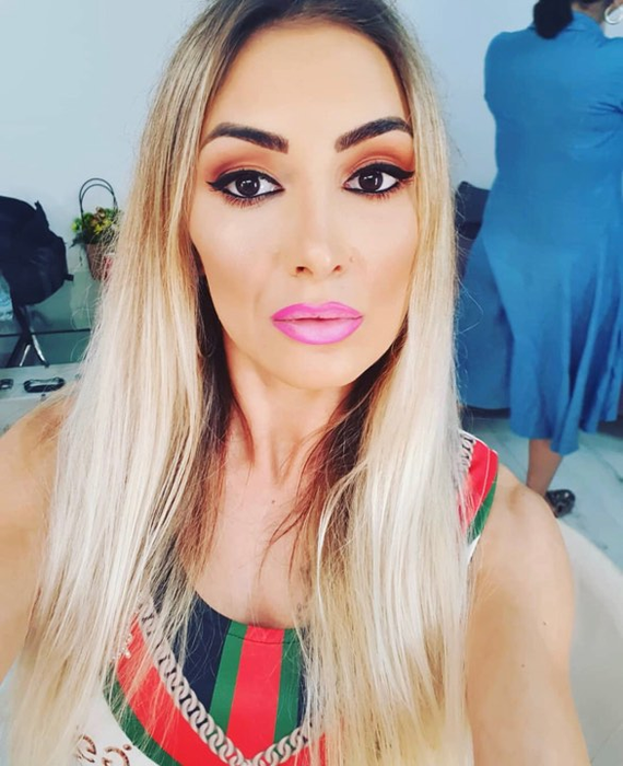 Prima imagine cu Sexy Brăileanca după ce și-a făcut intervenție estetică la nivelul feței