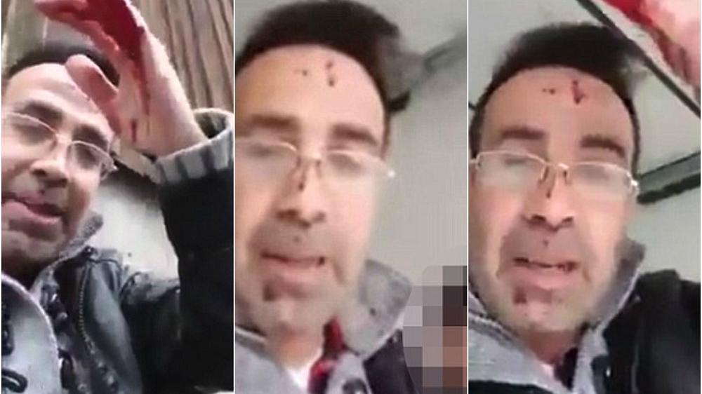 Imagini înfiorătoare! Plin de sânge, un bărbat a făcut live pe Facebook, după ce și-a înjunghiat mortal soția: „Așa sfârșești dacă îți enervezi soțul”