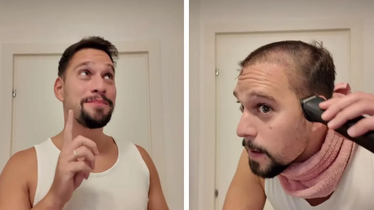 Vlad Gherman a apărut în public după cele 2 implanturi de păr. Cum arată acum