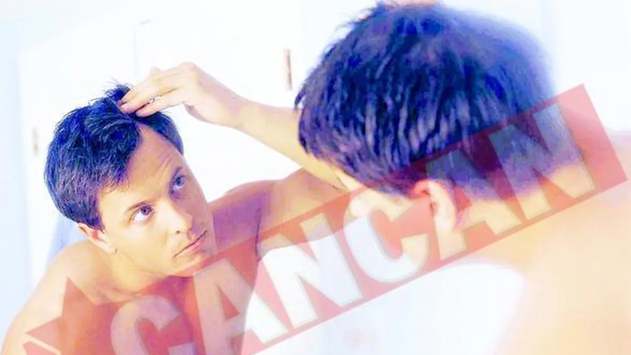 Dieta care previne pierderea parului