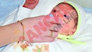 Bebelusul ars si-a revenit!