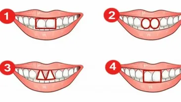 Test de personalitate inedit | Cum te caracterizează forma dinţilor? Spun totul despre tine