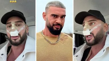 Dorian Popa, la un pas să îi „cadă nasul ca lui Michael Jackson”! Ce i-a descoperit medicul la operație? „Habar nu aveam”